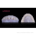 Zirconia crown